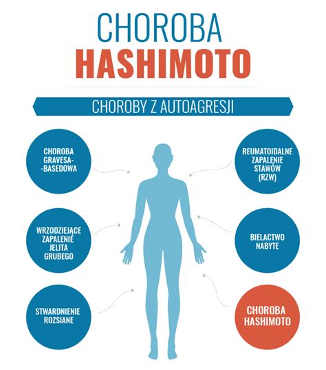 Choroba Hashimoto Przyczyny Objawy Leczenie Apteka Nowa Farmacja