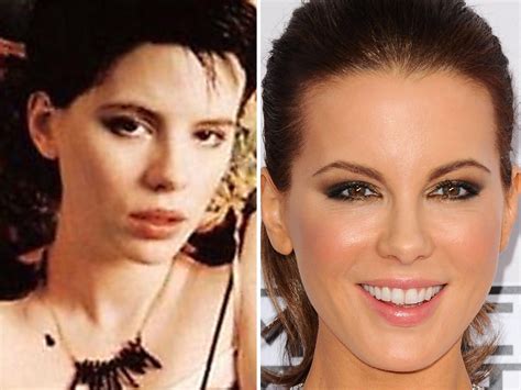 Pin By Laura Josserand On Amazing Transformations Amazing Transformations Plastic Surgery