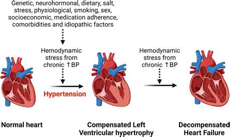 Frontiers Hypertensive Heart Disease Risk Factors Complications And
