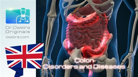 Journey Through A Healthy Colon Part2 Disorders And Diseases Youtube