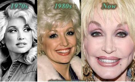 Considering dolly's love of plastic surgery, her appearance has changed a lot over the years, but she looks as incredible as ever today. Dolly Parton Plastic Surgery - Before and After - Top ...