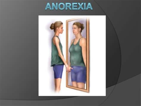 Anorexia Nerviosa Mentalmadrid