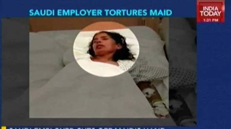 Saudi Employer Allegedly Cut Off Indian Domestic Maid S Arm After She Complained To Police About