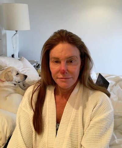 Caitlyn jenner appeared with no makeup for the first time and fans thought she looked great. Caitlyn Jenner Reveals Horrifying Damage to Her Face - The ...