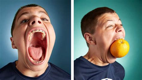 Minnesota Teen Reclaims Record For Largest Mouth Gape Guinness World