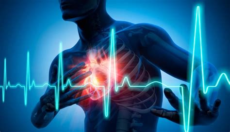 Eviter Les Accidents Cardiaques Causes Symptômes Et Traitement Dune