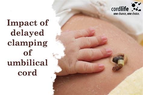 Impact Of Delayed Clamping Of Umbilical Cord Cordlife India