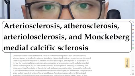 How I Study Arteriosclerosis Atherosclerosis Arteriolosclerosis
