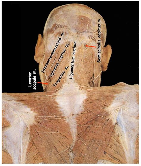 Continuous with the supraspinous ligament. trapezius dissection