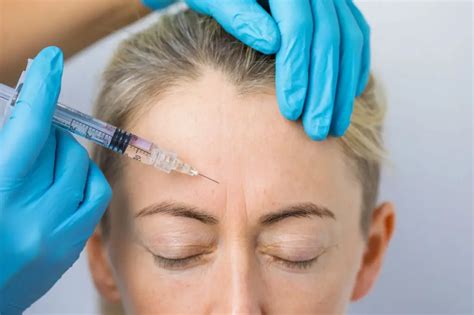 How Often To Get Botox On Forehead Gohealthline