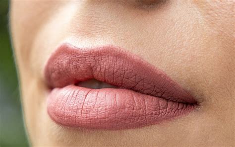 Natural Looking Lips With Lip Fillers Skin Excellence Clinics