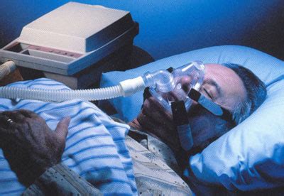Plicní hypertenze je zvýšení tlaku v plicnici nad hranici normy. Syndrom spánkové apnoe, SSA - příznaky, projevy, symptomy ...