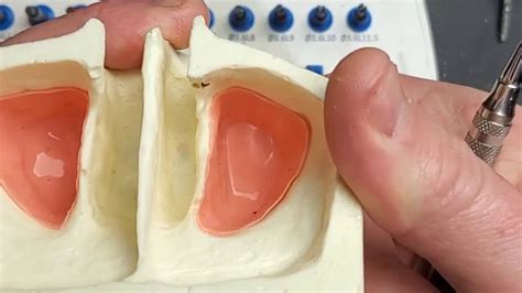 How To Use The Bsb Fully Guided Sinus Lift Kit In A Freehand Approach