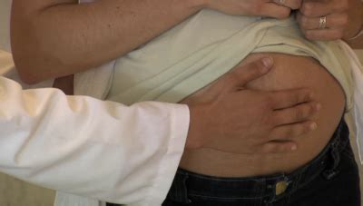 El aneurisma es una zona débil en la pared de un vaso sanguíneo que provoca que éste sobresalga o se abombe. O que é necessário saber sobre aneurisma da aorta abdominal? | Atividade Física | Blog ...