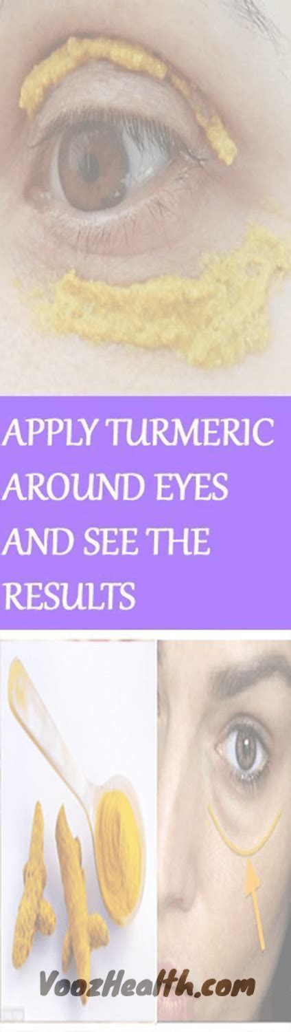 SHE STARTED APPLYING TURMERIC AROUND HER EYES 10 MINUTES LATER THE