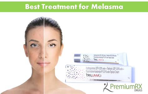 Best Treatment For Melasma Premiumrx Online Pharmacy