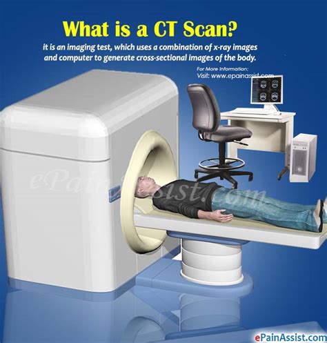 What Is A Ct Scan And Why Is It Doneprocedure Risks Duration Of Ct Scan