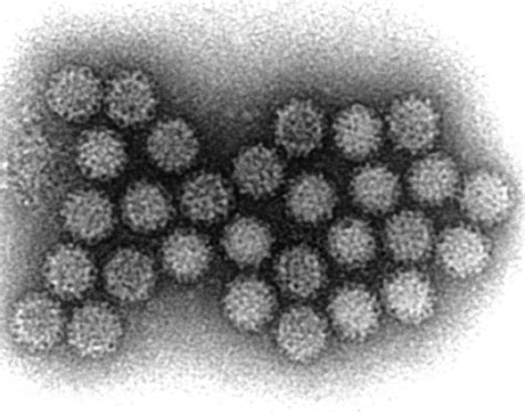 Norovirus Microbiology Medbullets Step 1