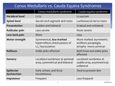 Conus Medullaris Syndrome Vs Cauda Equina Syndrome