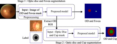 Optic Cup Segmentation