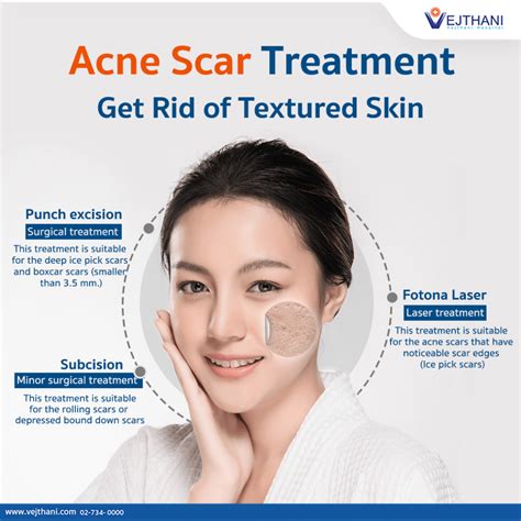 Get Rid Of Textured Skin With Acne Scar Treatment Vejthani Hospital