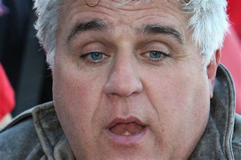 Jay Leno Recovering After Suffering ‘serious Burns From Gasoline Fire