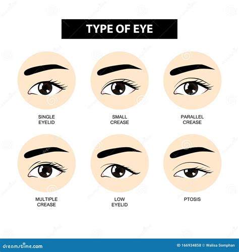 眼皮皱纹的类型 库存例证 插画 包括有 多个 自定义 眼珠 双倍 关心 级别 并行 化妆用品 166934858