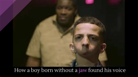 How A Boy Born Without A Jaw Found His Voice Alltop Viral