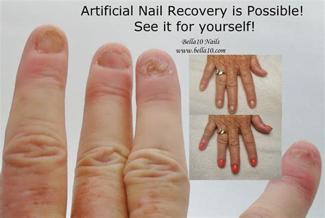 You can teach yourself to do acrylic nails. Bella10 Nails: The Secret to Artificial Nail Recovery