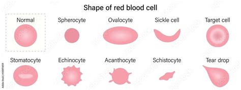 Red Blood Cell Morphology Shape Of Red Blood Cell Spherocyte