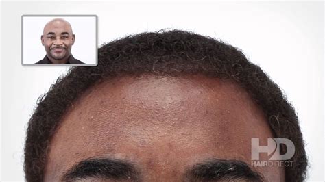 Hair units for men are simply bundles of hair strands, clips, beads and other hair accessories which are all designed to fit one head and are styled in unique shades and you might want your hair units for men to be either short or long, thick or thin, natural or artificial, dark or light hair and so on. African American Male Hair Replacement System - Hair ...