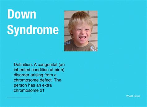 Down Syndrome Symptoms Health Info