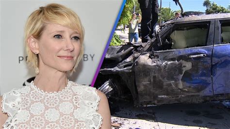 Anne Heche Car Crash Doctor Explains Her Burn Injuries The Global Herald