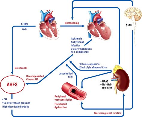 Congestive Heart Failure And Pulmonary Edema Concept Vrogue Co