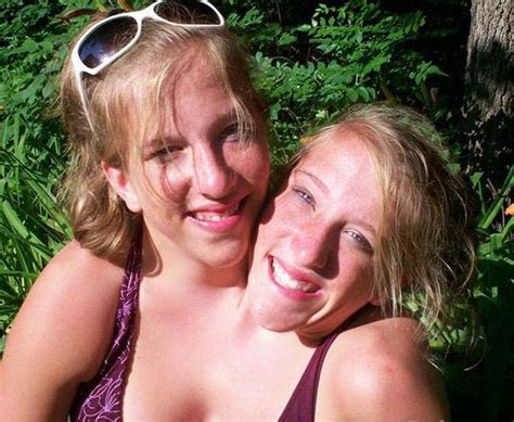 Conjoined Twins Abby And Brittany Married
