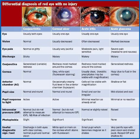 Plab King Acute Red Eye 8071700