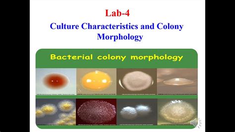 Lab 4 2020 Cultural Characteristics And Colonial Morphology Youtube