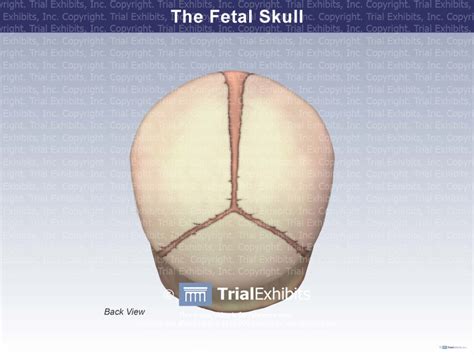 The Back View Of The Fetal Skull Trial Exhibits Inc