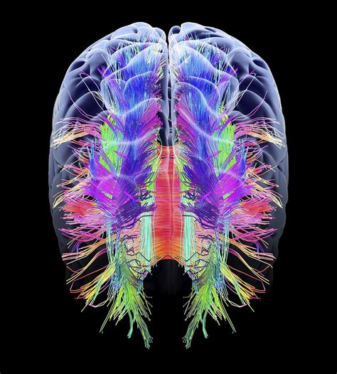 White Matter Fibres And Brain Artwork 2 Photograph By Science Photo