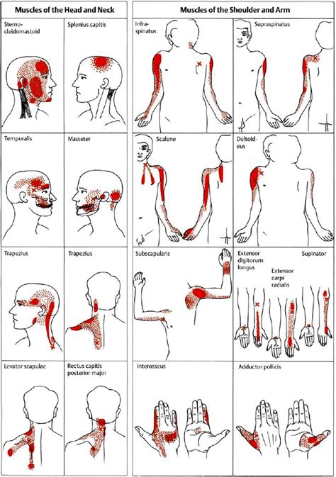 Massage Back Muscle Chart Pin By Andy Post On Exercises With Images Gym Workout A