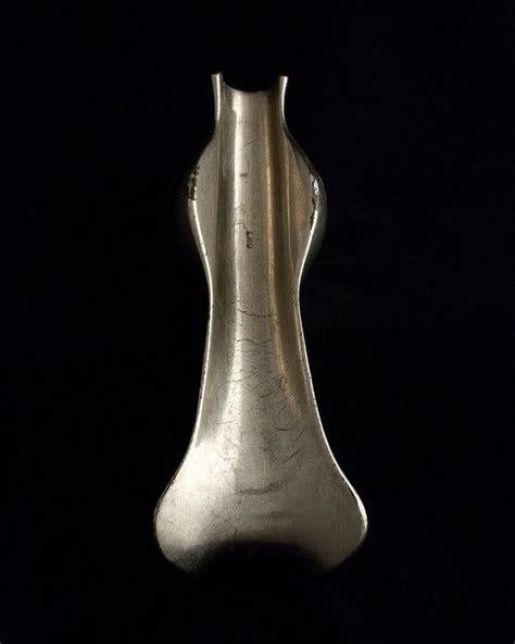 Photos Of Gynecological Tools From Centuries Past The New York Times