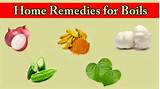Images of Home Remedies Redness Acne
