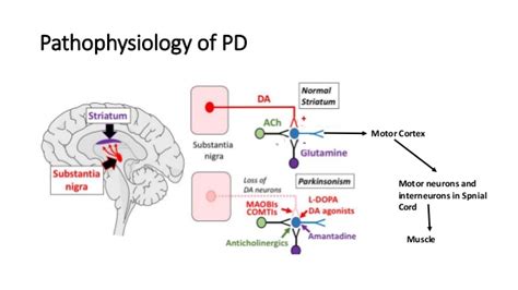 It likely involves the interaction of host susceptibility and environmental factors. Psychosis in parkinsons disease