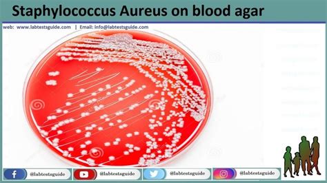 Staphylococcus Aureus Characteristics Biochemical Tests And Others