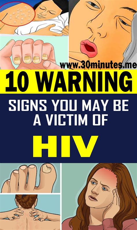 10 Warning Signs You May Be A Victim Of Hiv Health And Wellness