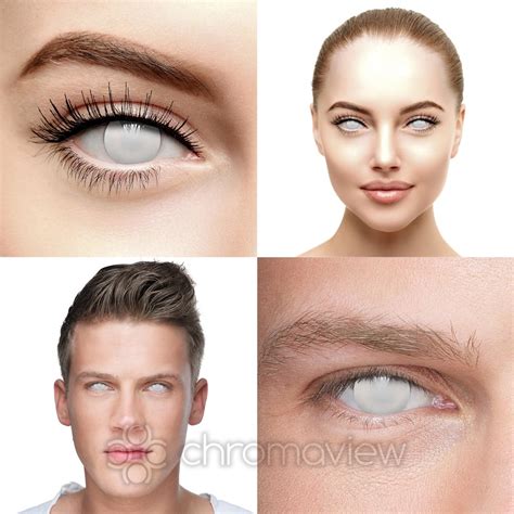 Blind White Contact Lenses 30 Day Chromaview Wholesale Us