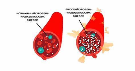Сахарный диабет диета стол номер Сахарный диабет 2 типа стол 8 - 80 фото Сахарный диабет 2 типа стол 8 - 80 фото Сахарный диабет диета стол номер