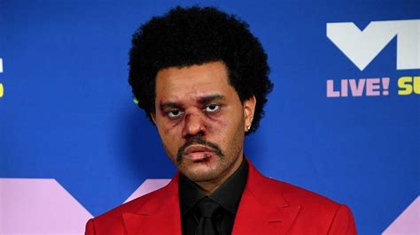 The weeknd, whose real name is abel makkonen tesfaye, got his start on youtube. Why The Weeknd Wore Bloody Face Makeup at the VMAs, What ...