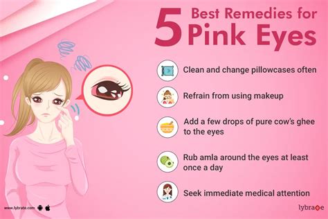 Quick Home Remedies For Conjunctivitis Pink Eye By Dr Anil Kumar