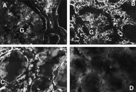Micrographs Representative Of Indirect Immunofluorescence Staining Of